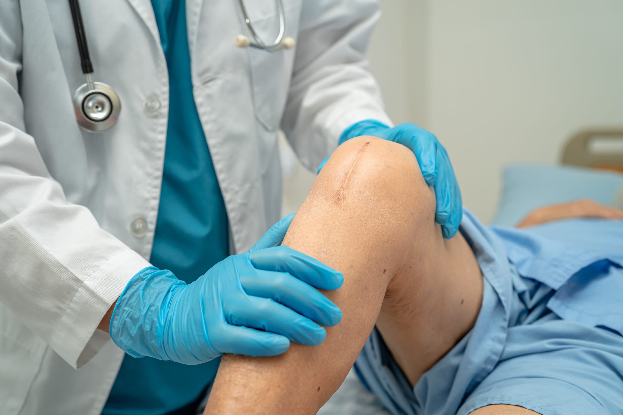 Post-operative knee scar being examined